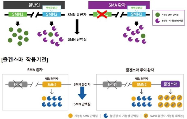 일반인과 SMA 환자의 차이. 출처=한국노바티스